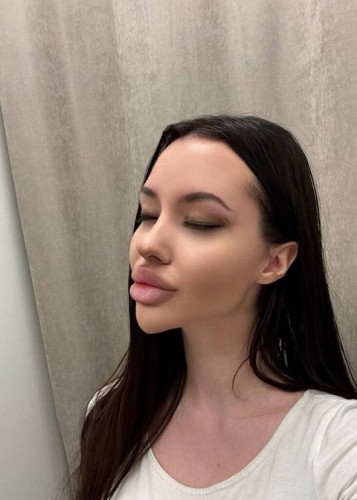 Лисса, Г. Новый Оскол